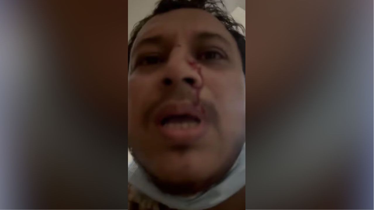 চাঁদা না দেওয়ায় চিকিৎসকের ওপর হামলা, ফেসবুক লাইভে রক্ষা